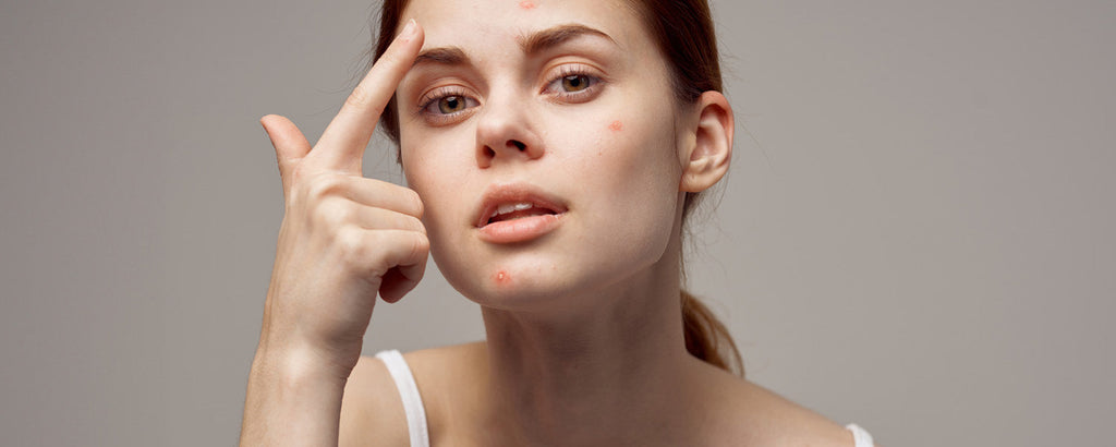 Pelle impura e imperfezioni: il ruolo nascosto del microbioma